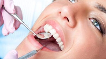 Dental Implants service