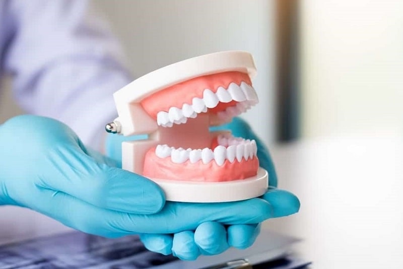 What You Should Know Before Getting Dentures
