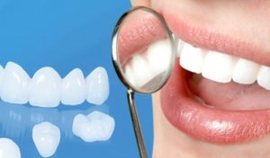 Cosmetic Vs. Restorative Care Dental