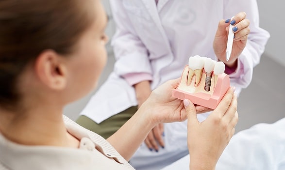 Dental Implants Vs. Veneers: Which Is Better to Restore Your Smile?