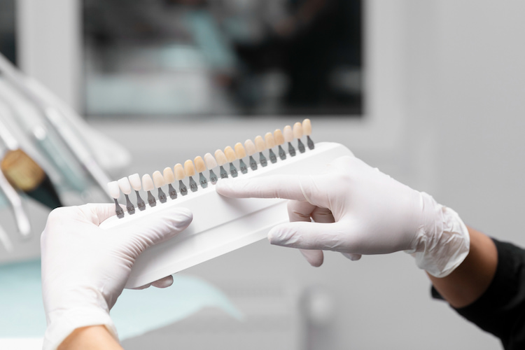 types of dental crowns