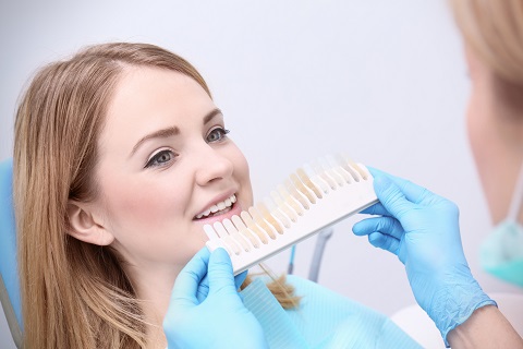 Ultimate Guide to Dental Veneers: Everything You Should Know