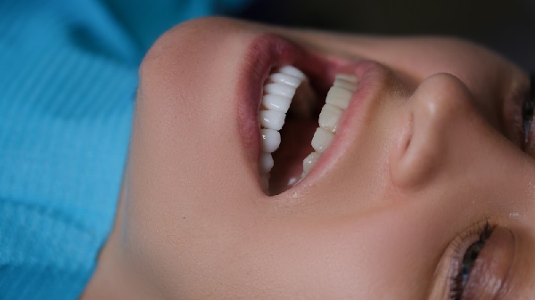 What Are the Most Common Tooth Replacement Options?