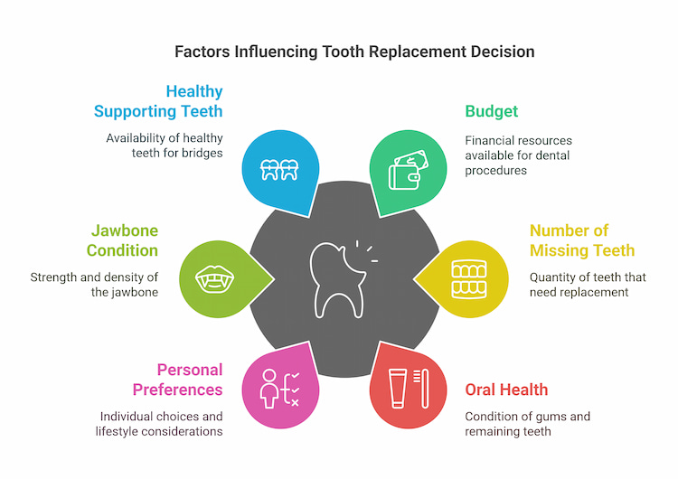 Tooth Replacement Options