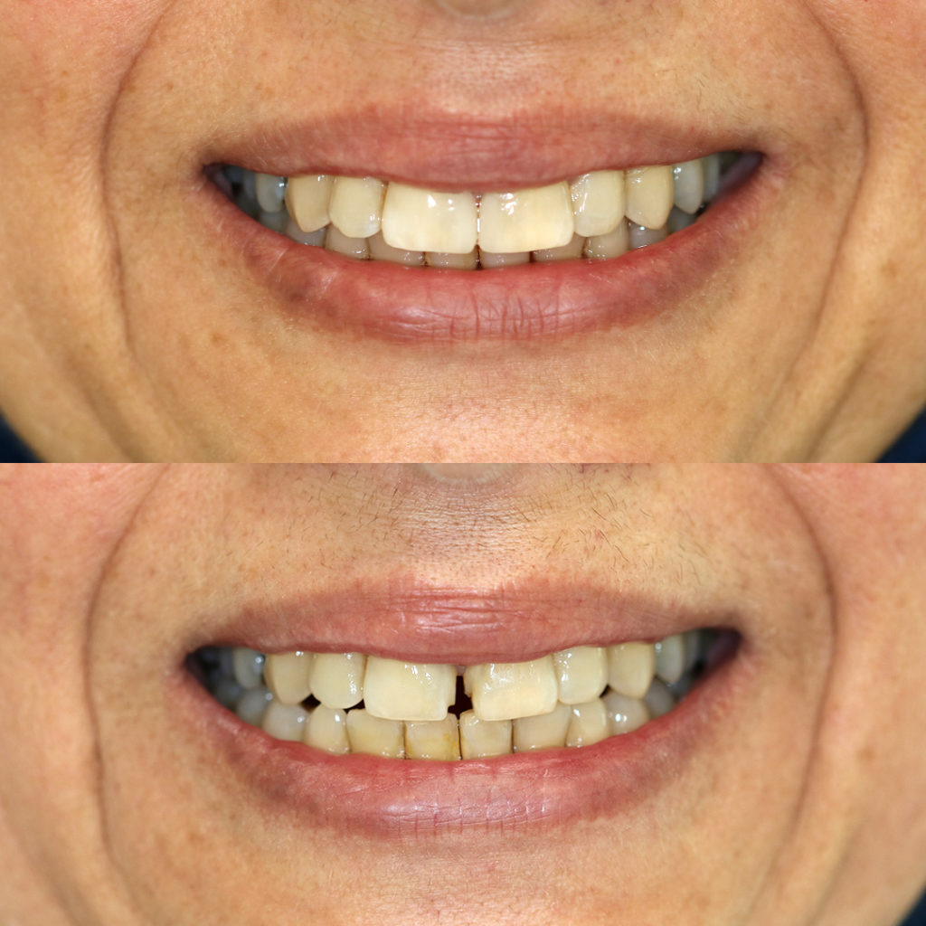 cosmetic dentistry