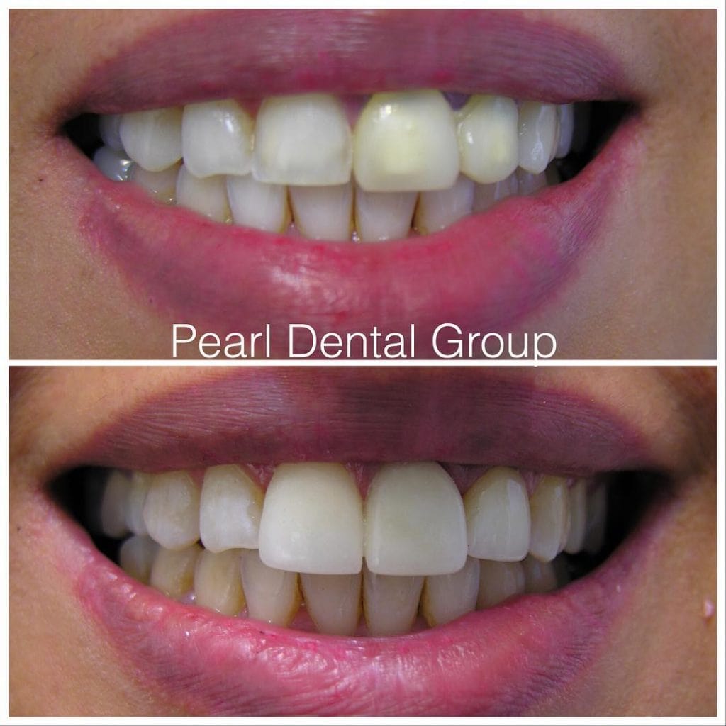cosmetic dentistry toronto