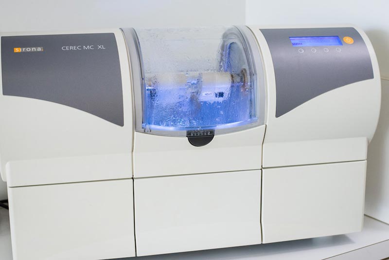 Cerec Crowns In Toronto