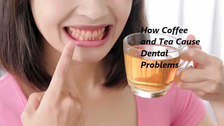 How Coffee and Tea Cause Dental Problems 