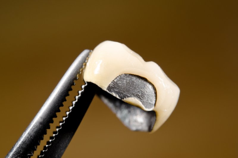 cracked crown solutions