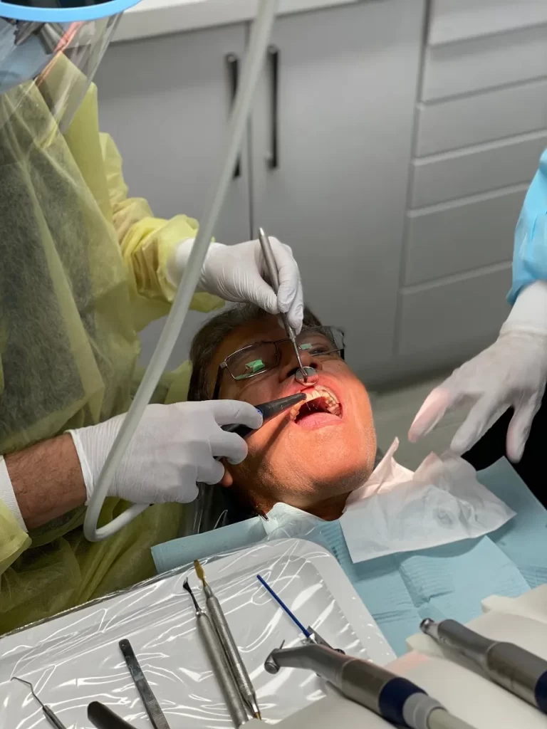 Cost of Dental Veneers Toronto