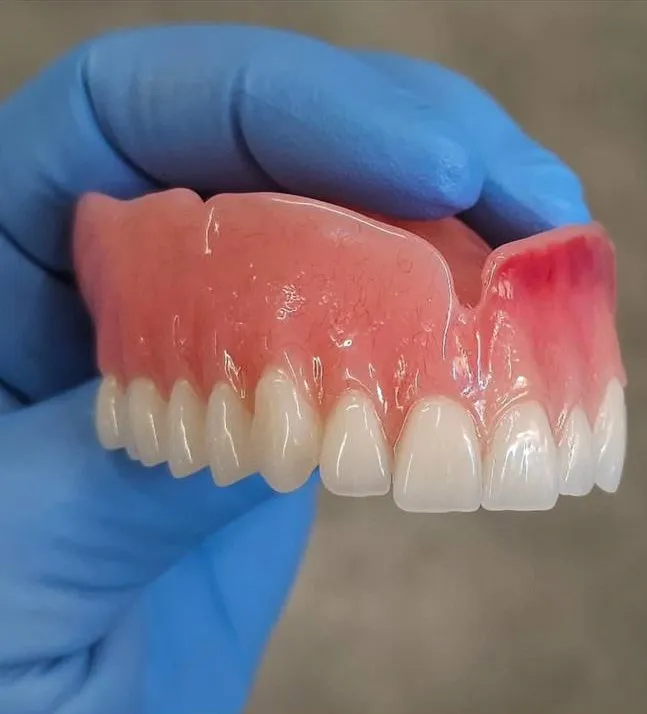 Affordable Dentures in North York