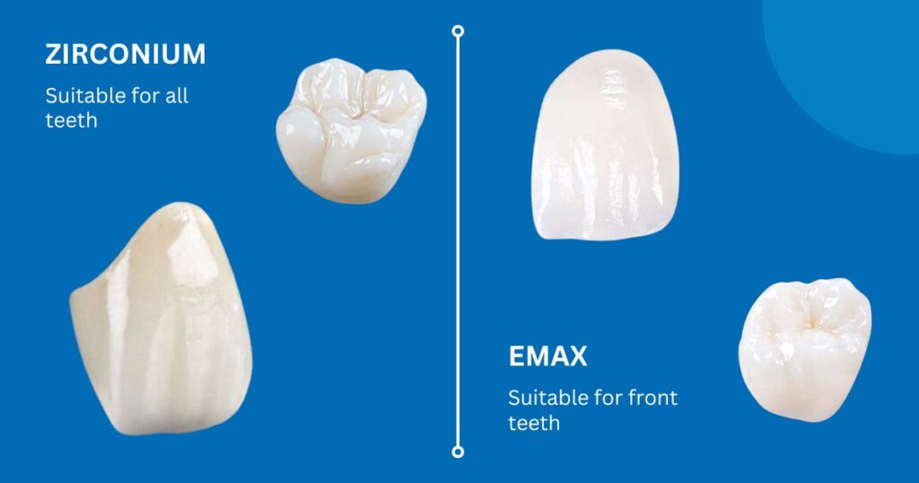 the best materials for dental crowns in 2026