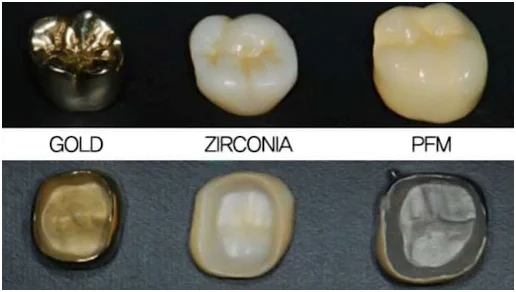 the best materials for dental crowns in 2026