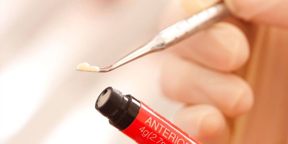 Whiten fillings on front teeth