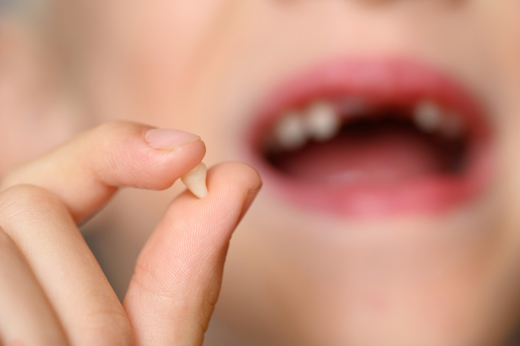 a photo of a patient holding a knocked-out tooth