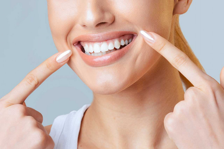 a photo of a woman showing healthy teeth