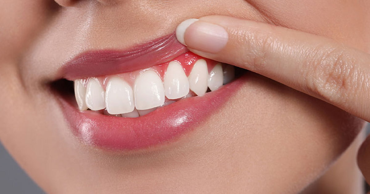 a photo of a patient with a tooth abscess