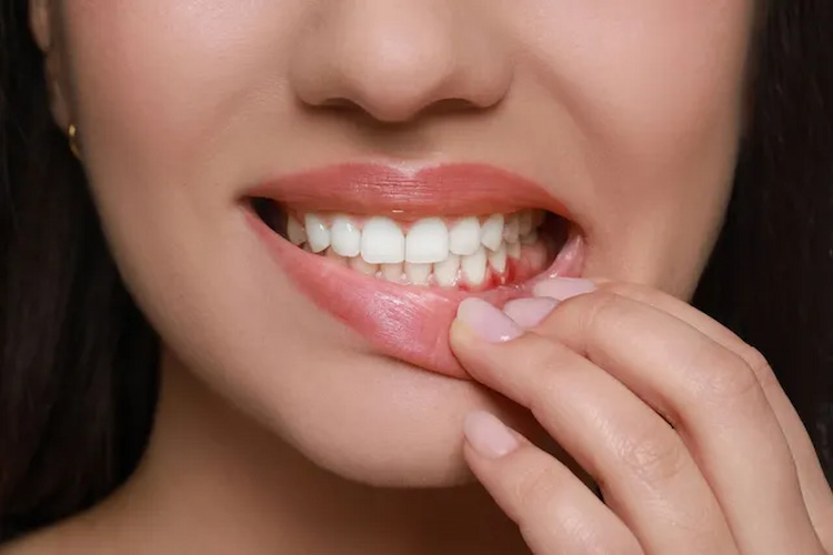 a photo of a woman in pain with tooth abscess symptoms