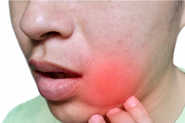 tooth abscess symptoms at lower jaw