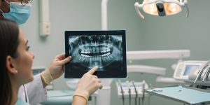Common Causes of Tooth Extraction Explained