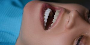 What Are the Most Common Tooth Replacement Options?