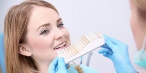 Ultimate Guide to Dental Veneers: Everything You Should Know