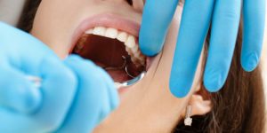 Reasons for Tooth Extractions