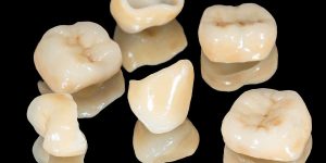dental crowns