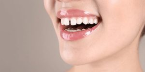 gaps between teeth