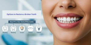 Options to Restore a Broken Tooth: How to Fix Your Smile Effectively