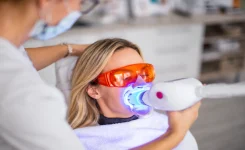 teeth whitening at pearl dental group
