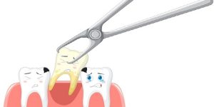 Common Alternatives to Having Your Tooth Extracted